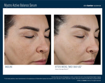 SkinBetter Science Mystro Active Balance Serum (1.7 oz)