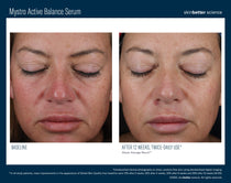 SkinBetter Science Mystro Active Balance Serum (1.7 oz)