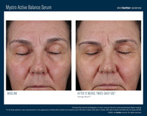 SkinBetter Science Mystro Active Balance Serum (1.7 oz)