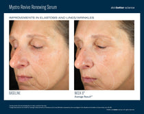 SkinBetter Science Mystro Revive Renewing Serum (1 oz)