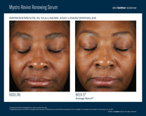 SkinBetter Science Mystro Revive Renewing Serum (1 oz)