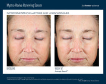 SkinBetter Science Mystro Revive Renewing Serum (1 oz)